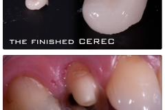 KDCFA-CEREC-Gallery-112340